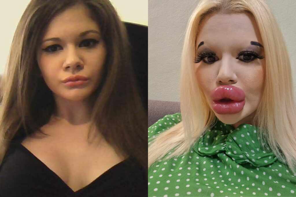 mujer con los labios más grandes del mundo