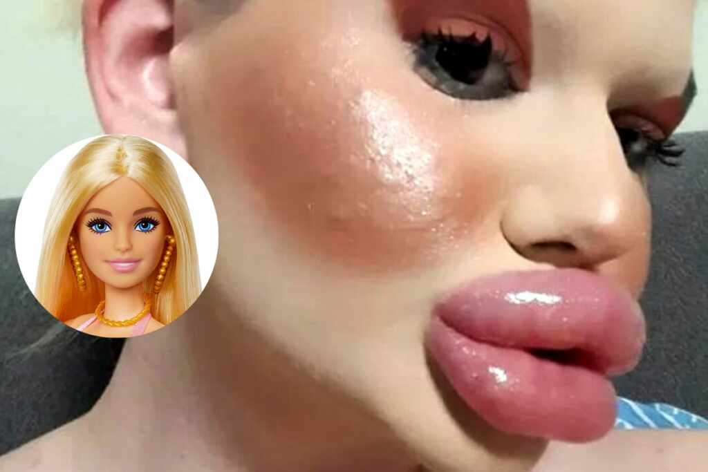mujer con los labios más grandes del mundo