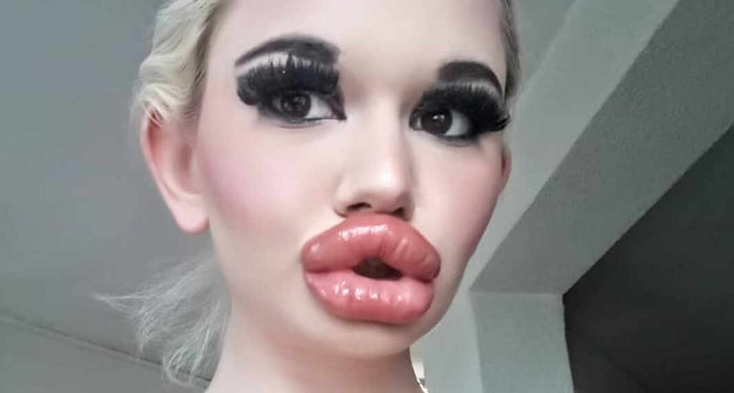mujer con los labios más grandes del mundo