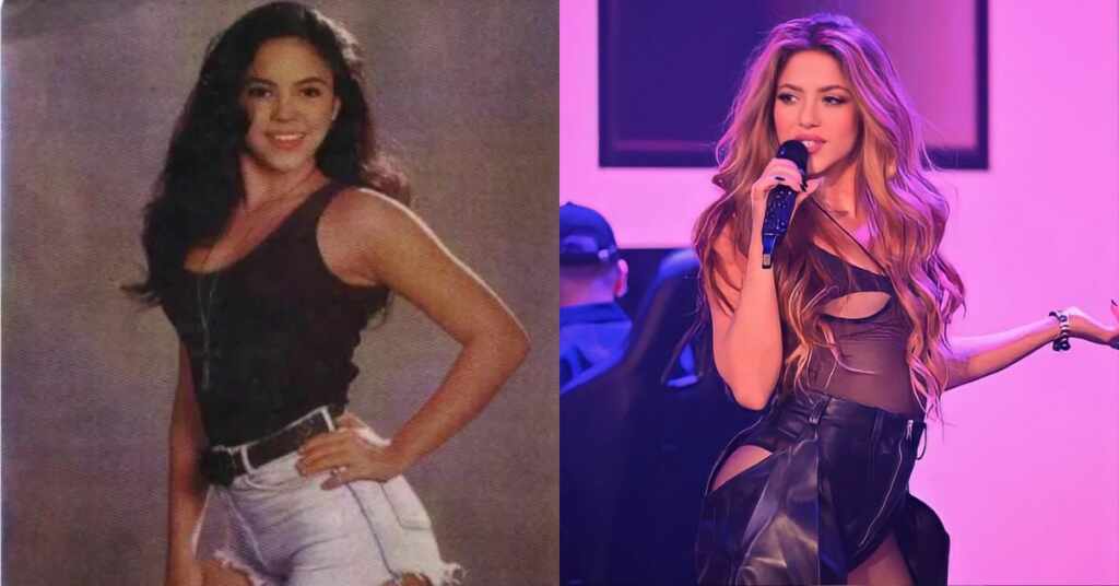 shakira antes y después cirugías y procedimientos estéticos