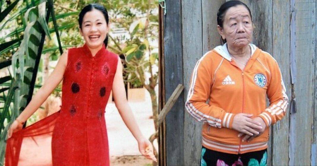 mujer vietnam envejeció 50 años en días