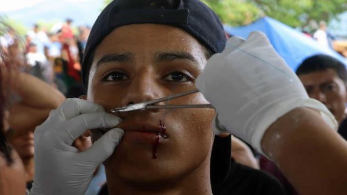 migrantes indocumentados en méxico cosen sus labios a modo de protesta ante la falta de visas humanitarias