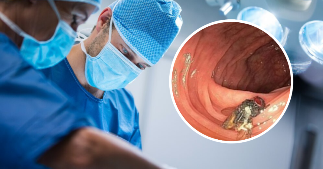 médicos encontraron mosca viva en el intestino de un hombre durante un examen